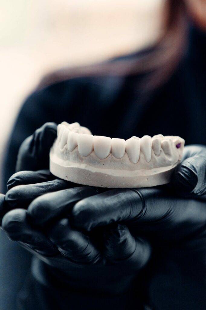 Paciente de carillas sonriendo durante su control, Colombia Care Dental, Medellín